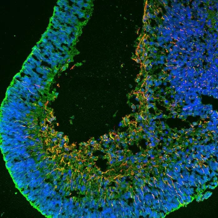 Cross-section of a retinal organoid, showing the location of different types of neurons such as ganglions (red) and Müller glia (green). (Image courtesy of Sergi Bonilla/Lancet eBioMedicine)