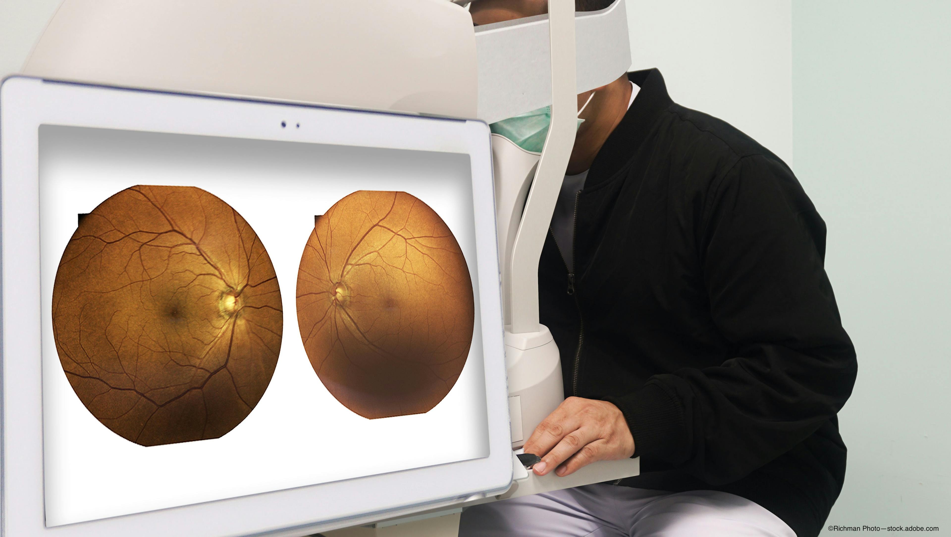 Teleretinal screening for diabetic retinopathy provides effective disease monitoring