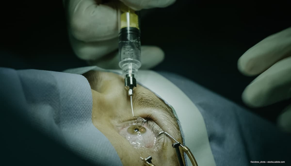 Applying cryopreserved amniotic membrane following intravitreal injection