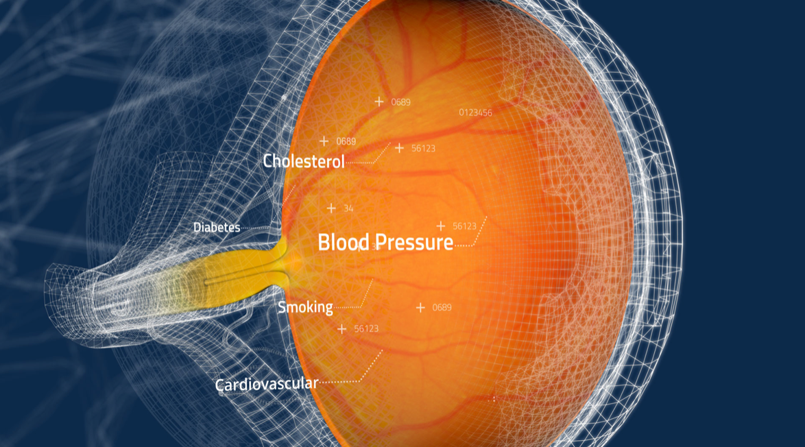 An image of the Toku CLAiR system. The AI-powered technology identifies elevated cardiovascular risk by analysing minute changes in the retina and its vasculature. Image courtesy of Toku Inc.