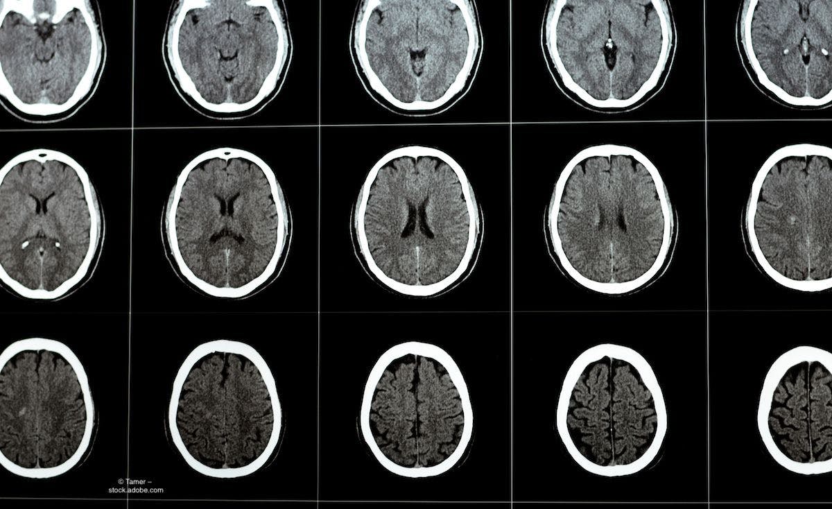 A series of images of brain scans. Image credit: © Tamer – stock.adobe.com